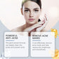 Acne Soothing Serum Hydrating Moisturizing Pimple Care Mild Solution