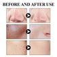 West Month Blackhead Mud Mask Oil Control Pore Shrinking