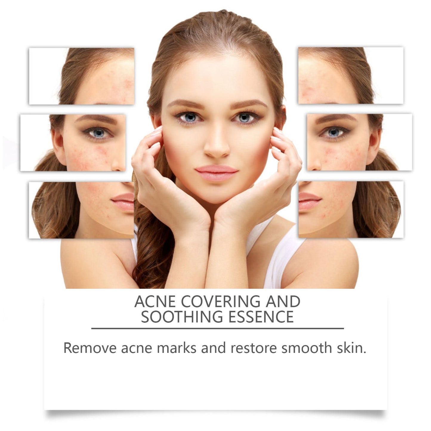 Acne Soothing Serum Hydrating Moisturizing Pimple Care Mild Solution