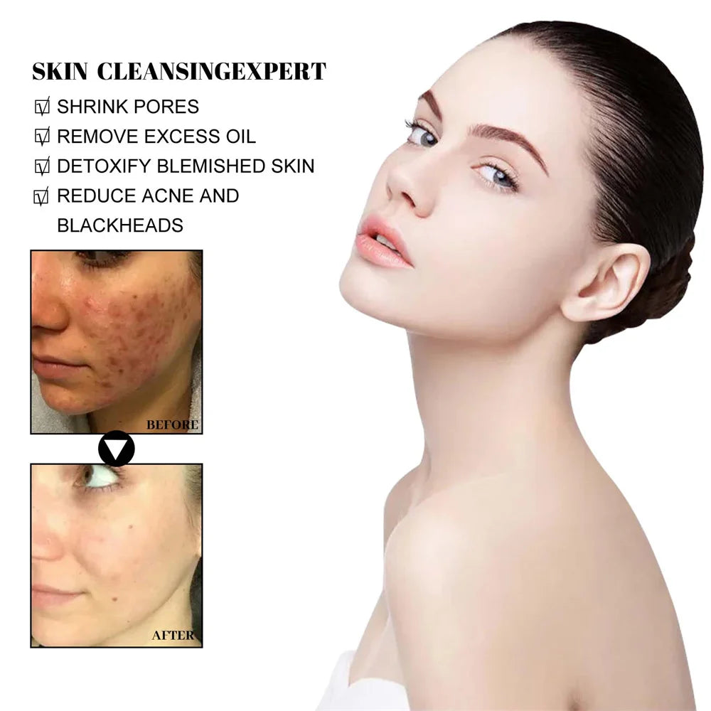 West Month Blackhead Mud Mask Oil Control Pore Shrinking